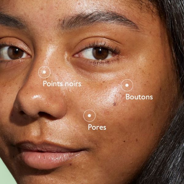 Vinopure Sérum Salicylique Anti-Imperfections 30 ml