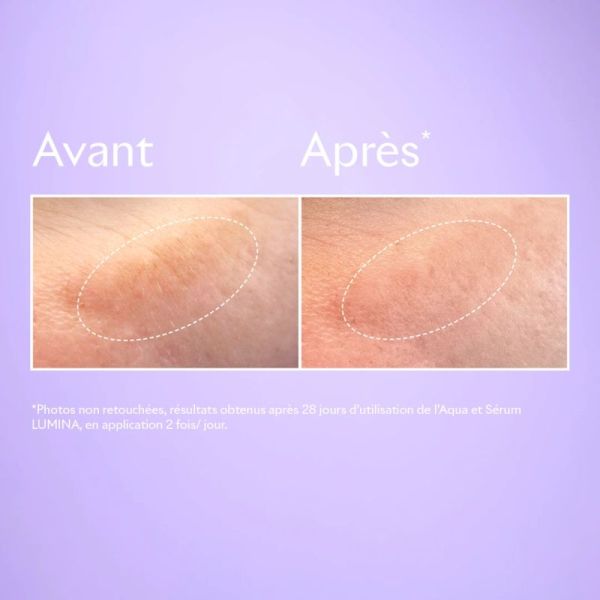 LUMINA SERUM ECLAT ANTI-TACHES - 30 ML